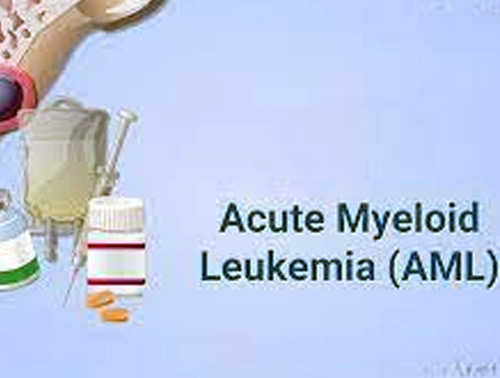 Acute Myeloid Leukemia