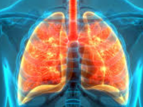 Idiopathic Pulmonary Fibrosis