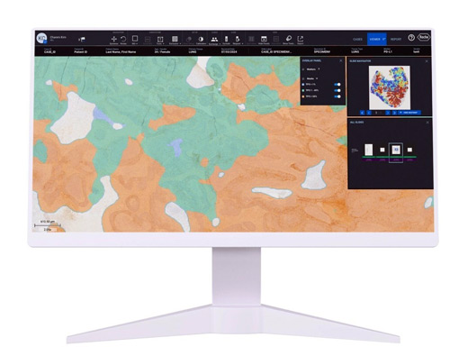 Lunit joins Roche's Digital Pathology Open Environment to advance cancer biomarker testing