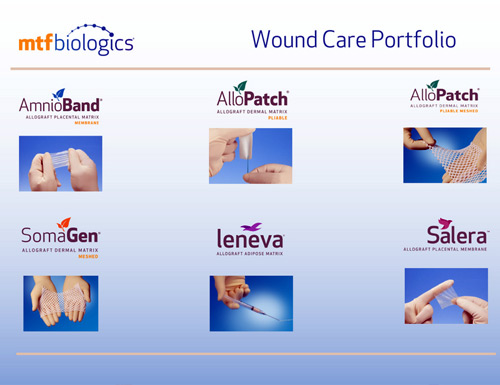 MTF Biologics and Centurion Therapeutics Partner to Expand Access to Advanced Wound Care Technologies