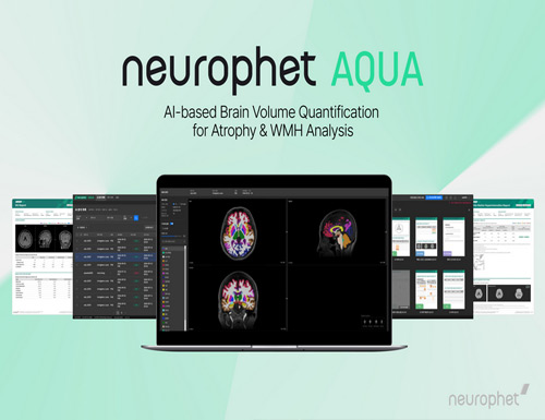 Neurophet gains FDA 510(k) clearance for Neurophet AQUA, advancing multiple sclerosis analysis with AI-driven precision